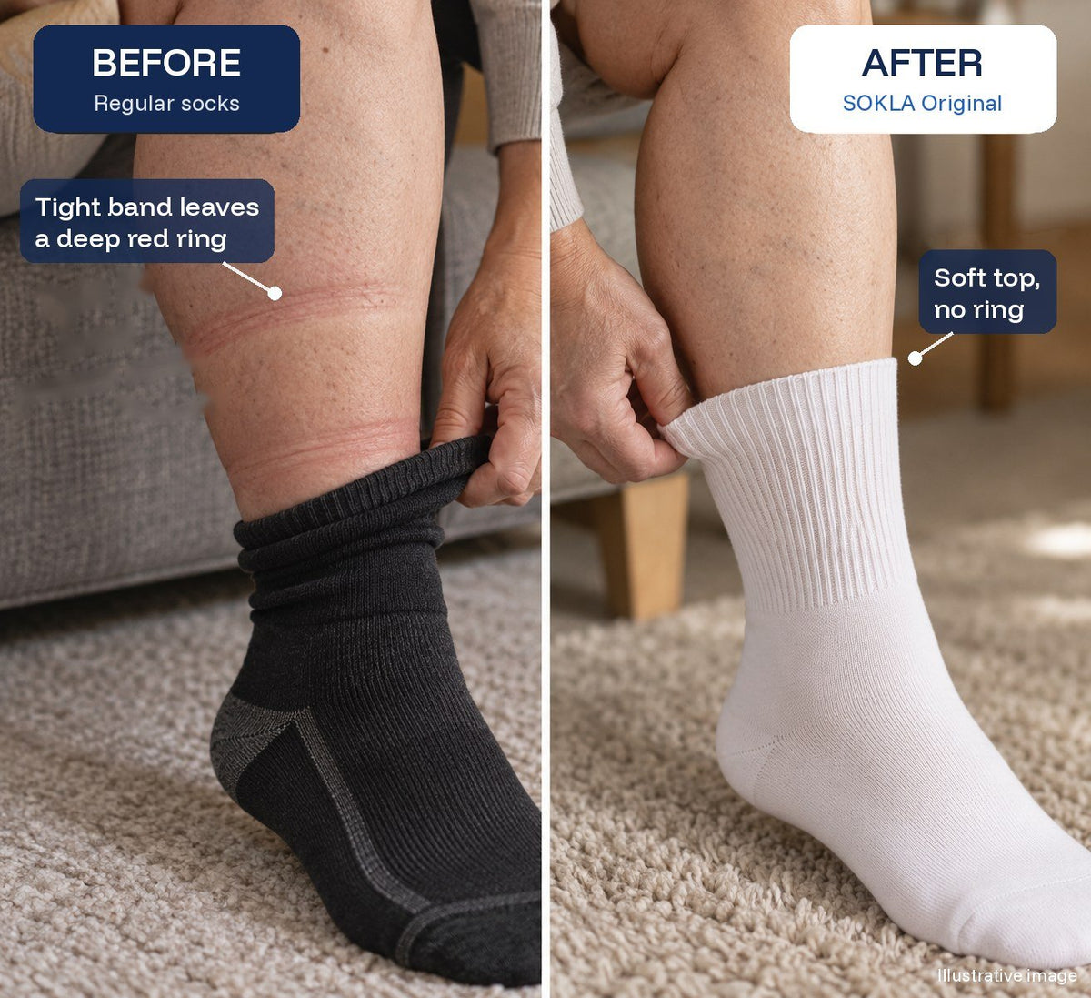 Illustrative before and after: regular sock leaves a red ring, SOKLA Original does not